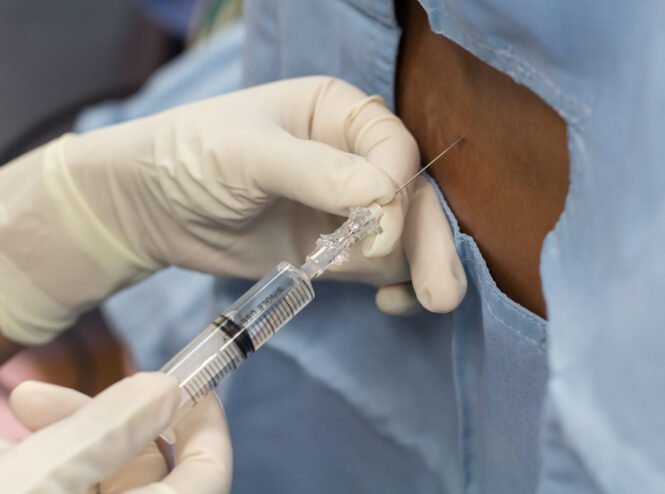 labioplasti.com.tr sitesi anestezi seçimi yazısı tema görseli