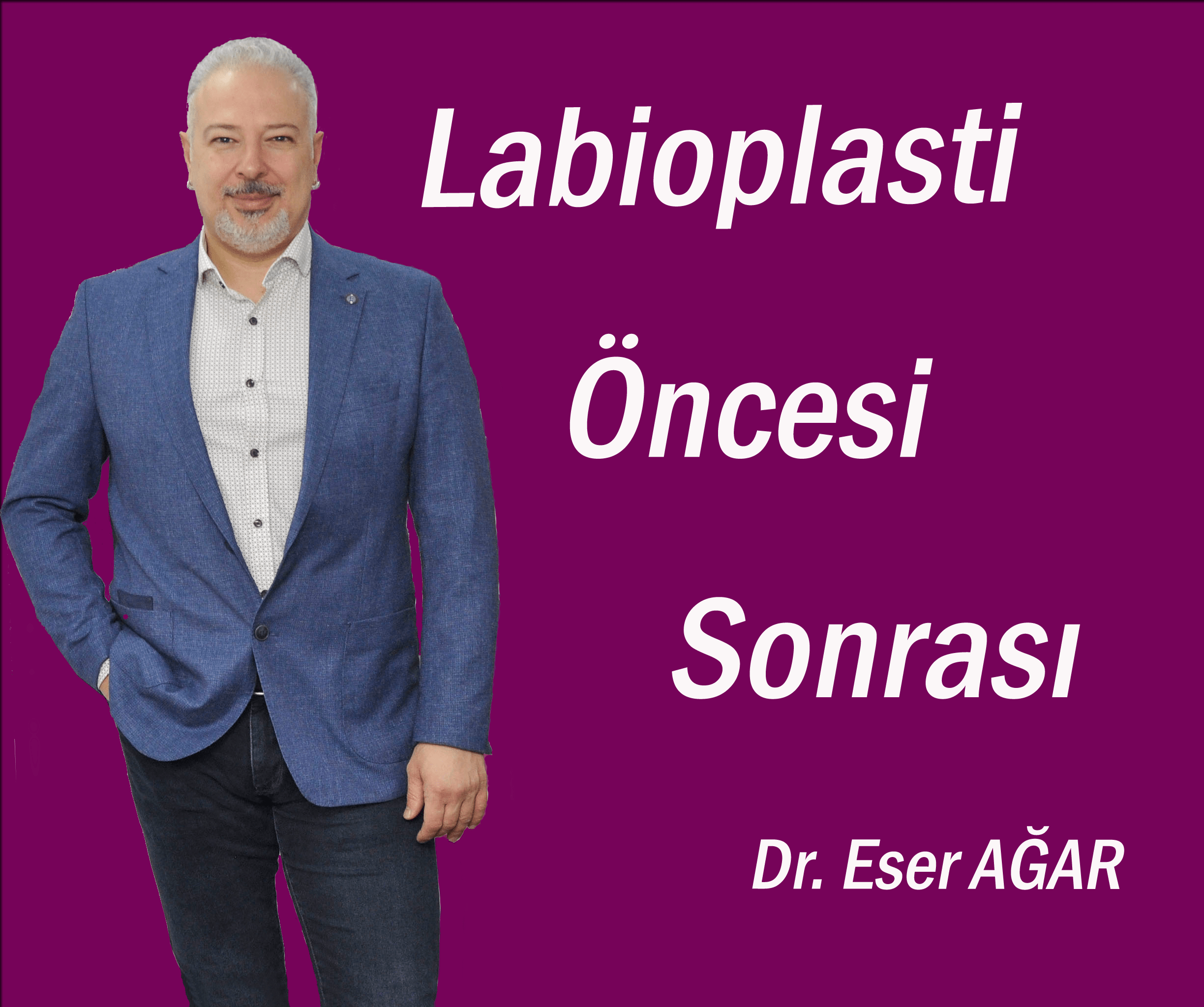 labioplasti öncesi sonrası video kaplaması